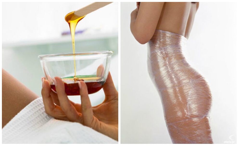 ara murasilẹ fun àdánù làìpẹ